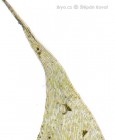 Brachythecium albicans 